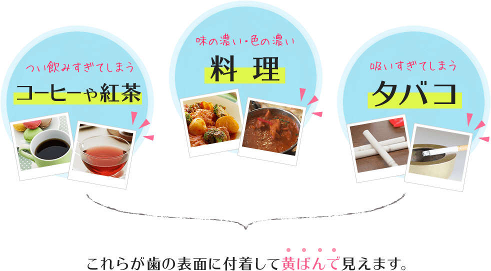 つい飲みすぎてしまうコーヒーや紅茶/味の濃い・色の濃い料理/吸いすぎてしまうタバコ これらが歯の表面に付着して黄ばんで見えます。