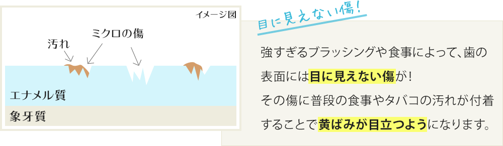 強すぎるブラッシングや食事によって、歯の表面には目に見えない傷が!その傷に普段の食事やタバコの汚れが付着することで黄ばみが目立つようになります。