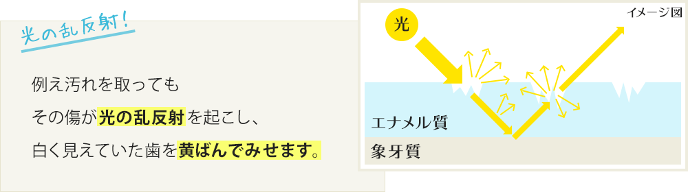 例え汚れを取ってもその傷が光の乱反射を起こし、白く見えていた歯を黄ばんでみせます。