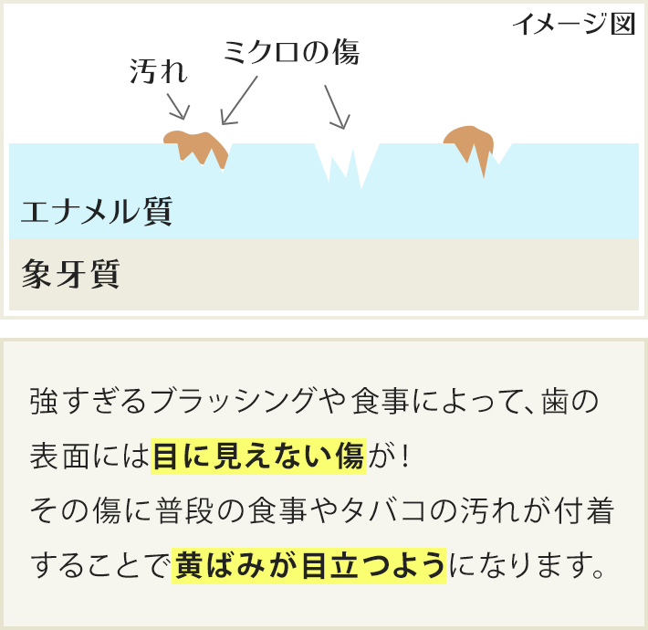 強すぎるブラッシングや食事によって、歯の表面には目に見えない傷が!その傷に普段の食事やタバコの汚れが付着することで黄ばみが目立つようになります。