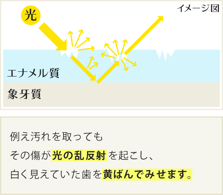 例え汚れを取ってもその傷が光の乱反射を起こし、白く見えていた歯を黄ばんでみせます。